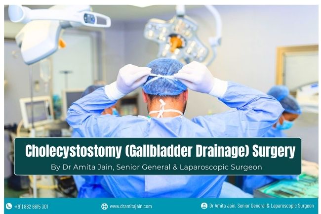 Cholecystostomy Gallbladder Drainage Surgeon in Delhi Dr Amita Jain Dr Amita Jain